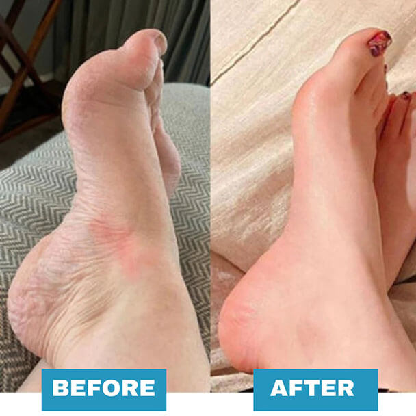 Worldrito™ Bio SkinCare | EMS Foot Massager